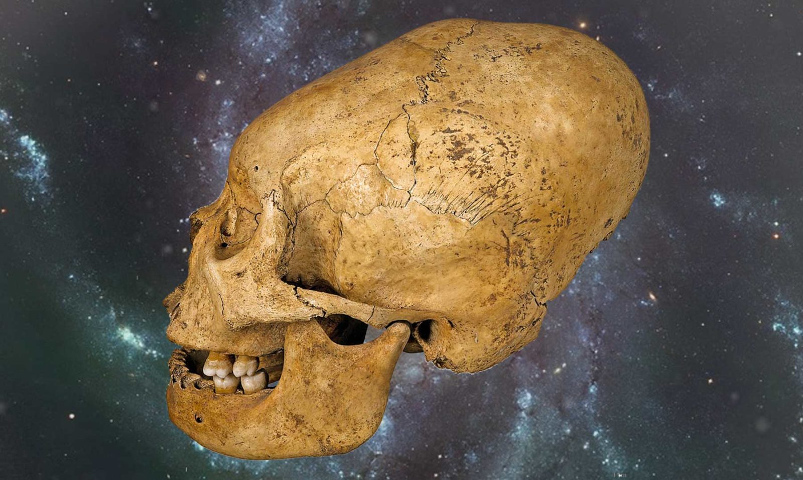El misterio de los Cráneos alargados: ¿Pruebas de una Civilización Desconocida?