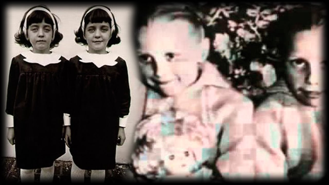 El Misterio de las Gemelas Pollock, un caso de Reencarnación documentado por Científicos (Video)