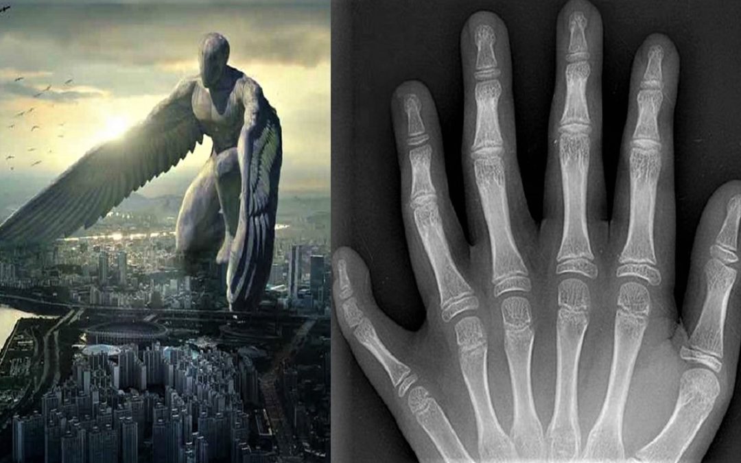 Los «ángeles caídos» y el extraño fenómeno de los seis dedos (Video)