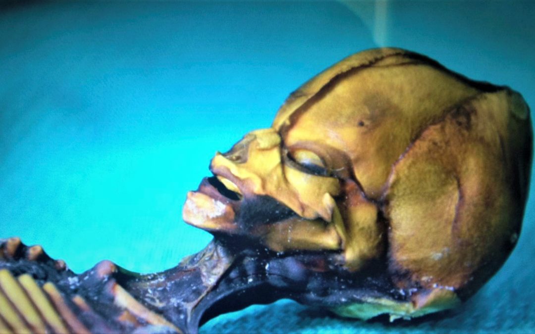 Resuelven el misterio de la «momia alienígena» de Atacama (Video)