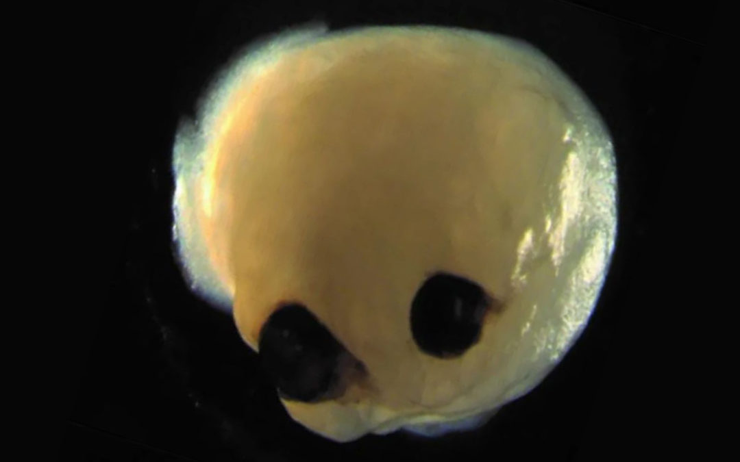 Organoides: Mini cerebros creados con células madre desarrollan ojos